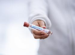 Цена на российскую вакцину от коронавируса станет известна в ближайшие дни