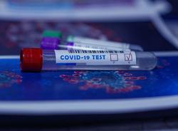 В Петербурге сделали 37,8 тысяч тестов на коронавирус за сутки